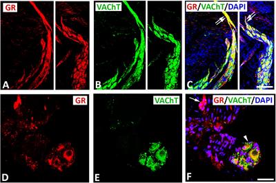 Identification of glucocorticoid receptors as potential modulators of parasympathetic and sympathetic neurons within rat intracardiac ganglia